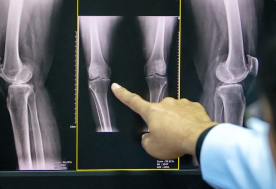 Orthopaedic Surgeon in Staffordshire Consultation